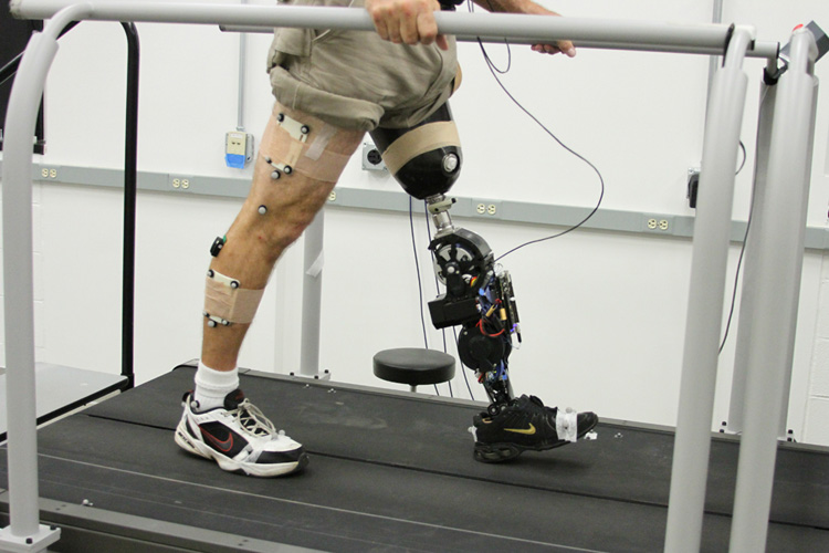 Cost a leg. Prosthesis экзоскелет. Buy Bionic prosthetic Leg. Остем prosthetic Kit. Robotic Legs real.